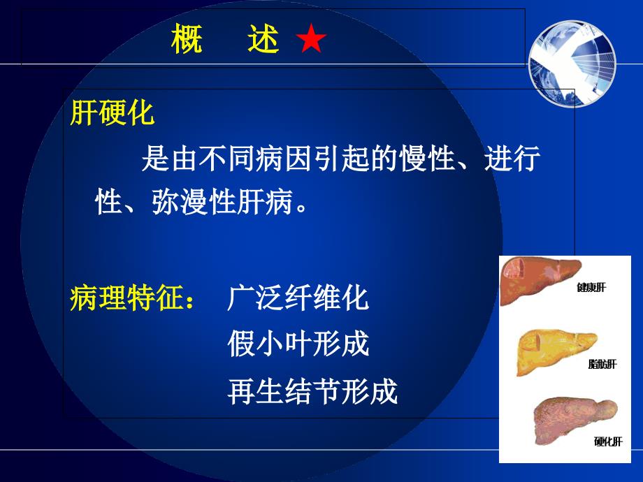 肝硬化教学课件_第4页