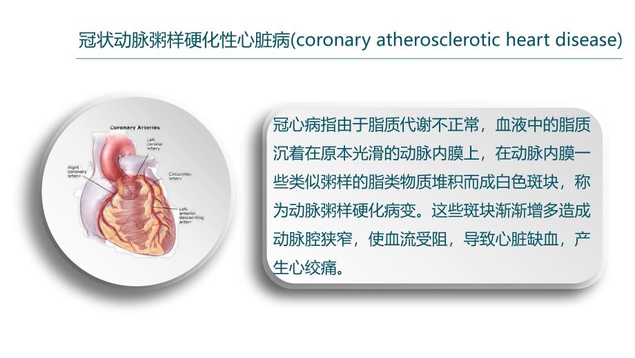 脑出血护理查房.ppt_第4页