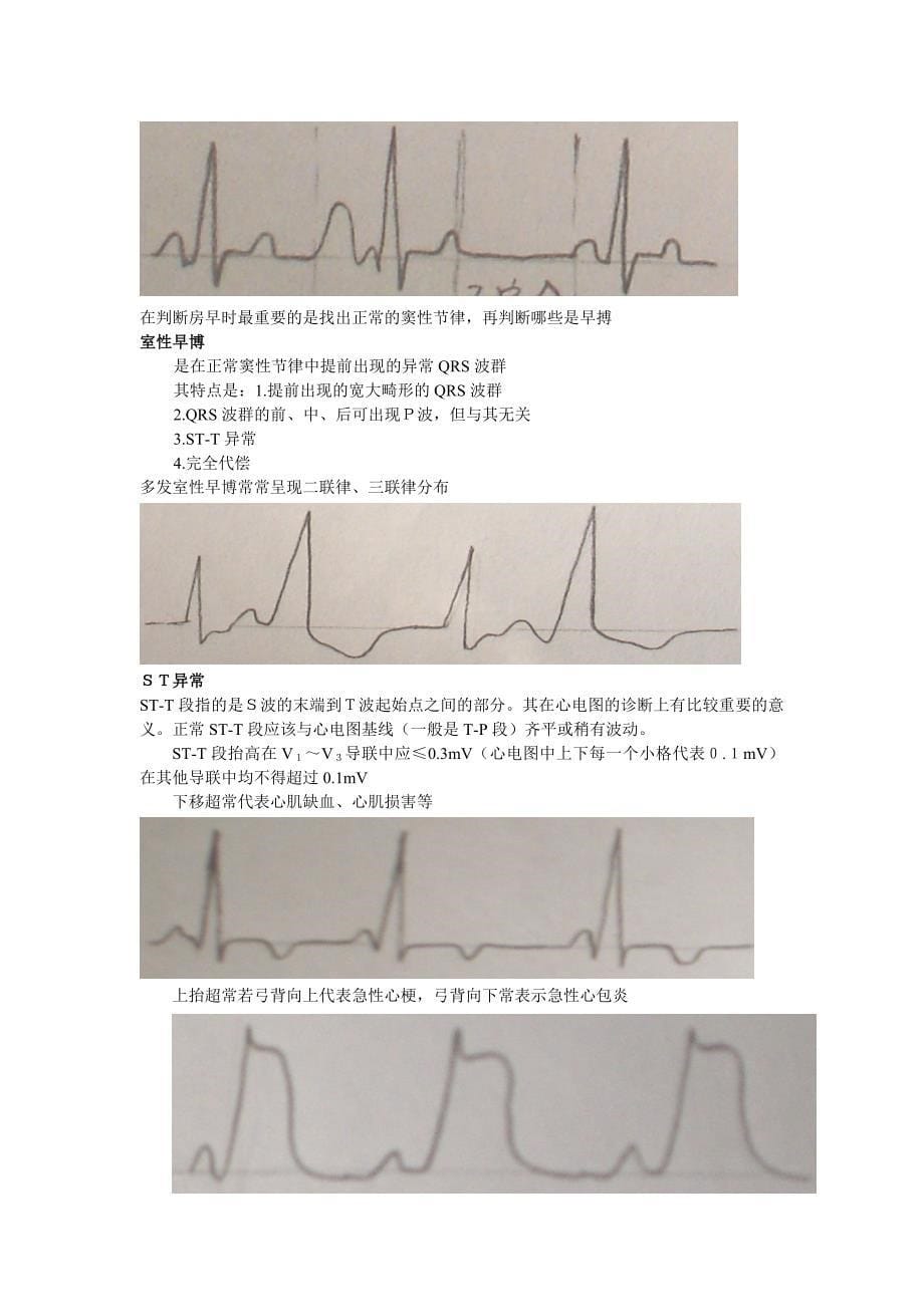 心电图室实习经历.doc_第5页