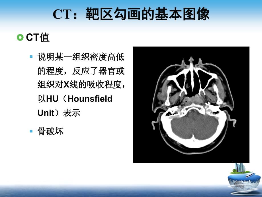 诊断方法PPT课件_第4页