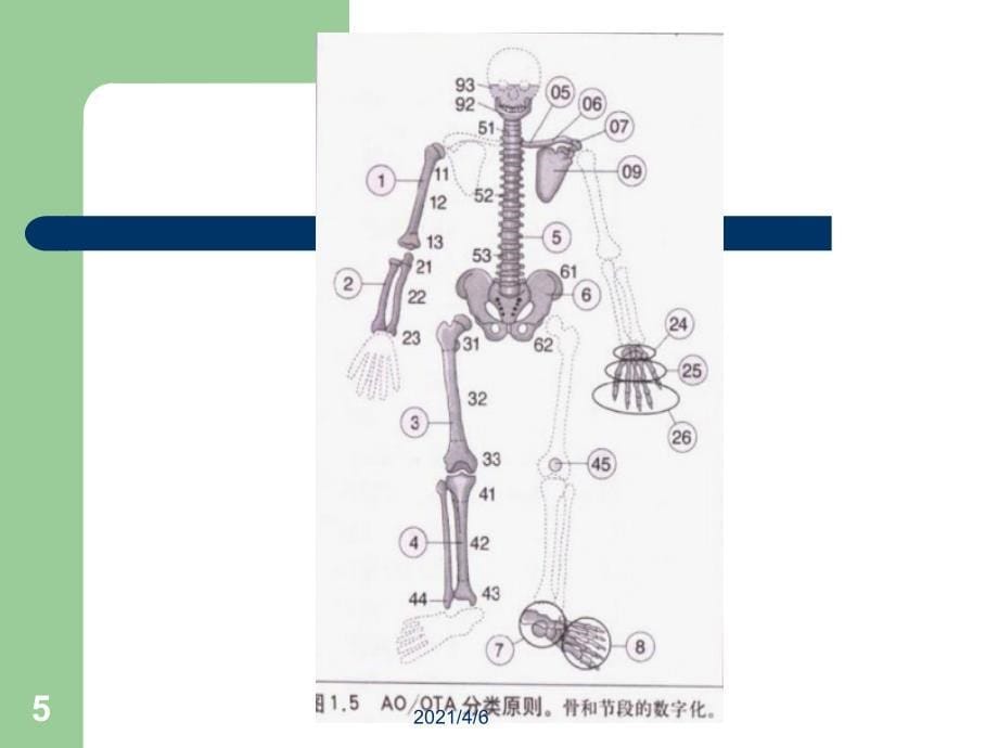 骨折分型文档资料_第5页