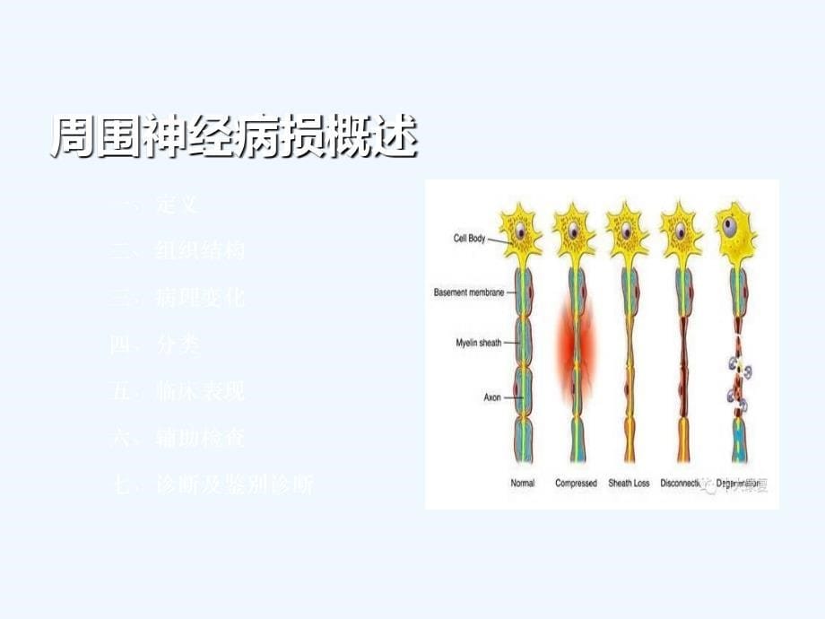 常见神经疾病的评定技术_第5页