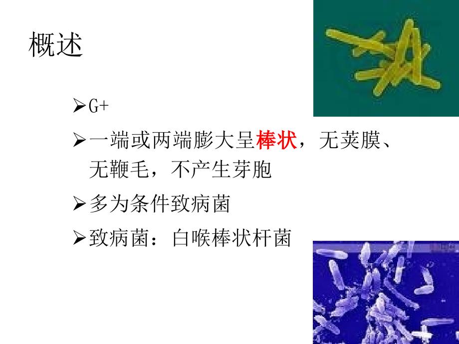 最新十四章棒状杆菌属CorynebacteriumPPT课件_第2页