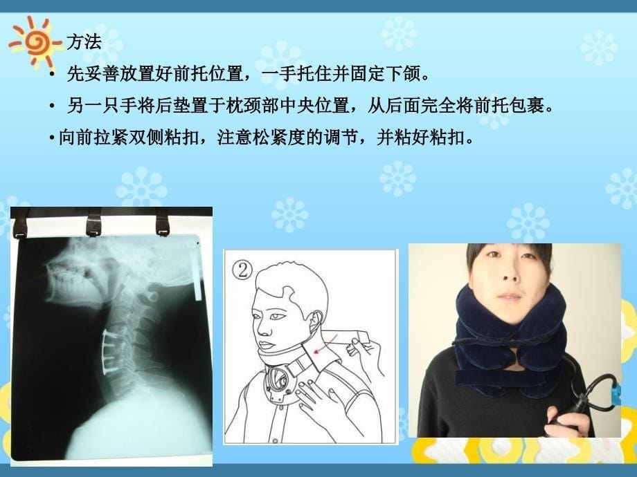 课件：骨科常用康复器具的使用及护理PPT课件.ppt_第5页