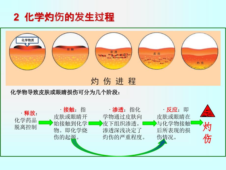 酸碱化学灼伤、化学品腐蚀培训.ppt_第4页