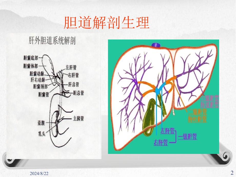 《胆囊结石伴胆囊炎》课件_第2页