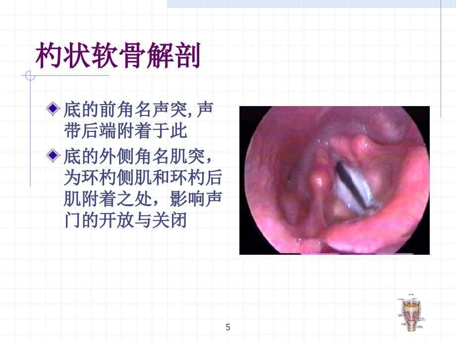 杓状软骨脱位的原因及处理_第5页