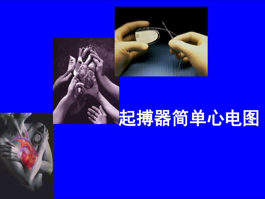 起搏器心电图PPT课件_第1页