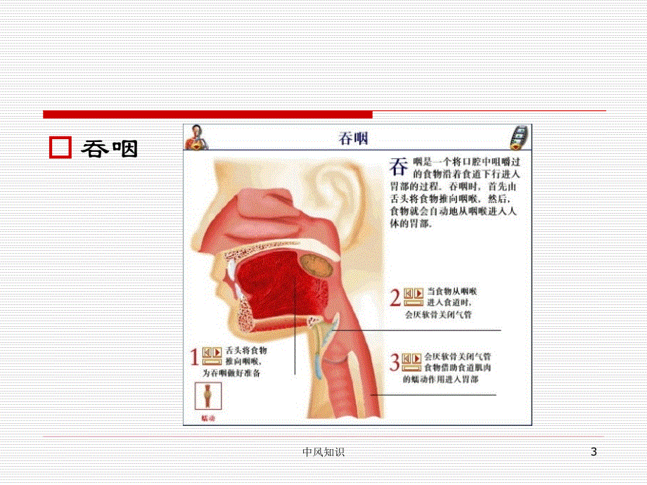 中风后吞咽障碍的康复治疗（专业应用）_第3页