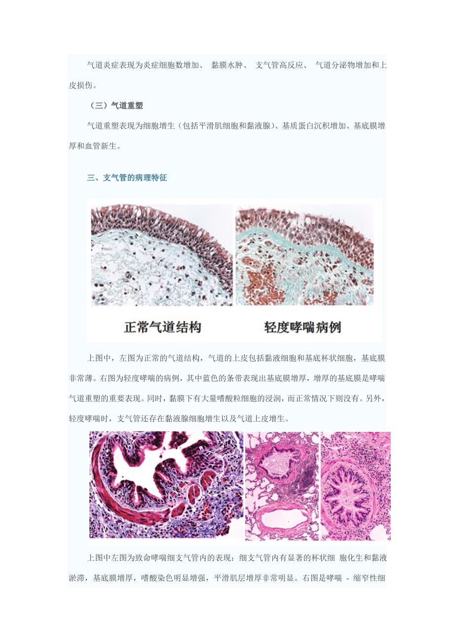 重症哮喘的概述_第2页