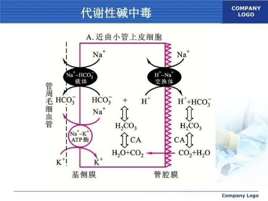 代谢性碱中毒26416讲课稿_第5页