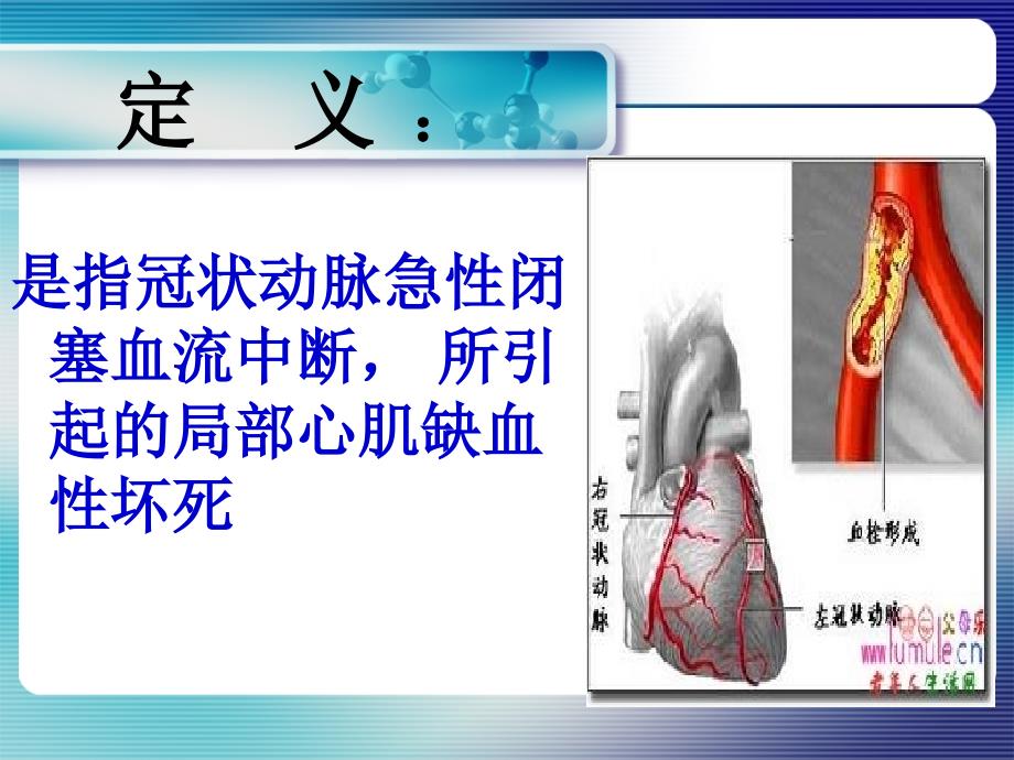 急性心肌梗死抢救护理PPT课件_第4页