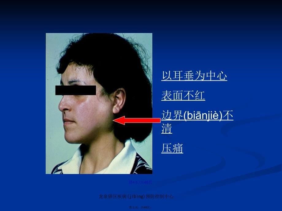 传染病防控知识宣传学习教案_第5页