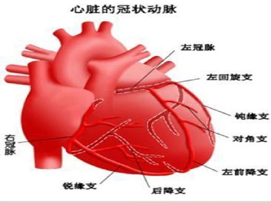 急性前壁心肌梗死护理查房ppt课件.ppt_第3页