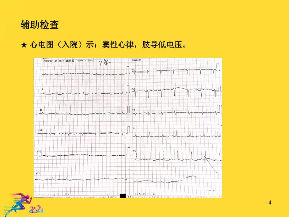 淀粉样变性心肌病一例优秀文档课件_第4页