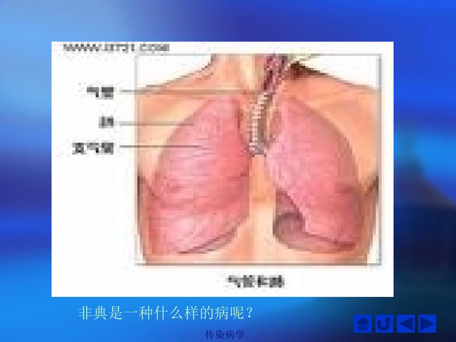 医学第七课时SARS手足口病腮腺炎_第4页