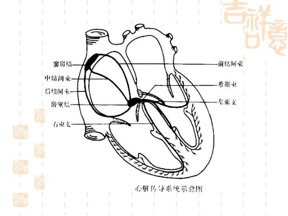 最新心律失常检验本科PPT课件_第5页