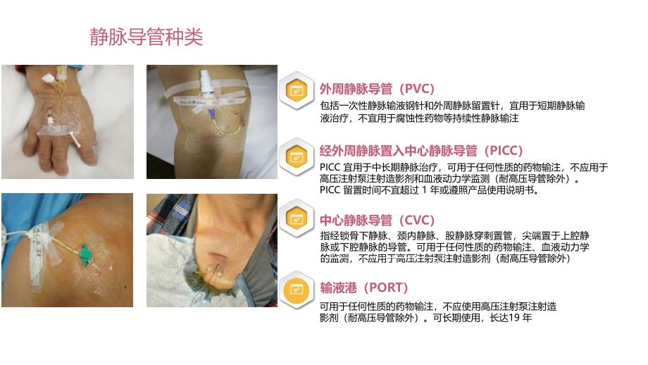 医学各种静脉导管的固定方法培训课件_第2页