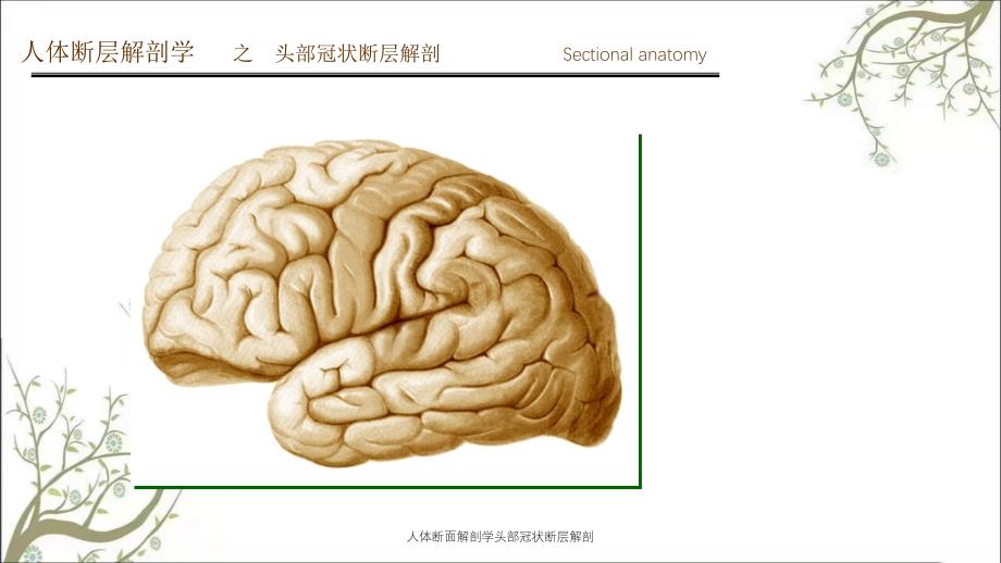 人体断面解剖学头部冠状断层解剖_第2页