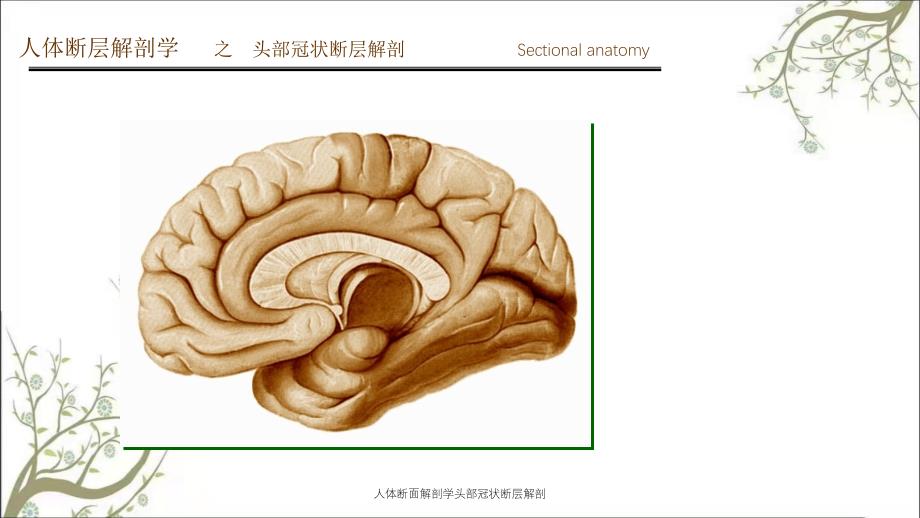 人体断面解剖学头部冠状断层解剖_第3页