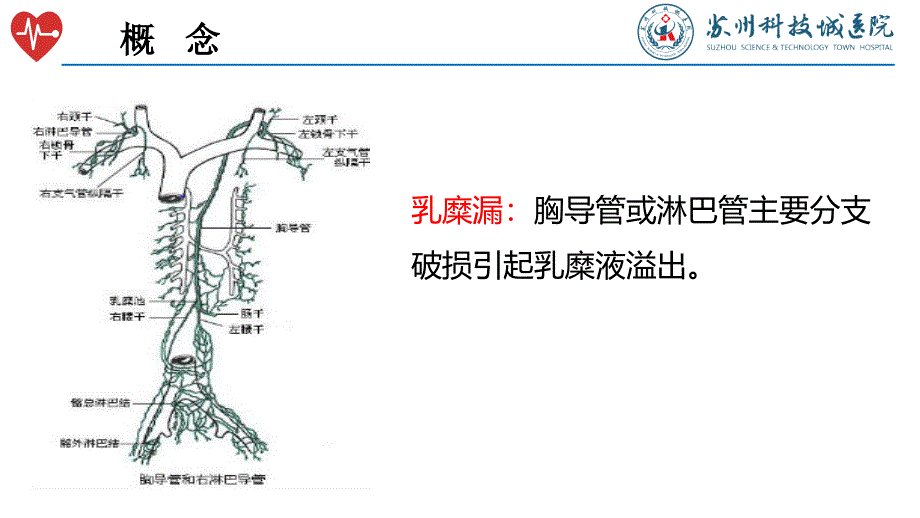 甲状腺术后淋巴漏的护理_第3页