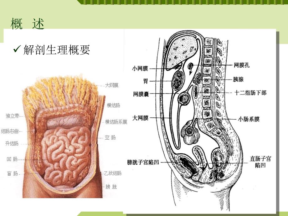 急性化脓性腹膜炎病人的护理_第4页