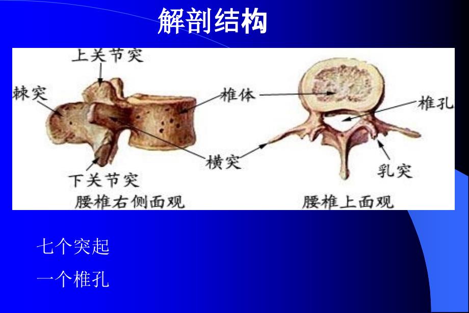 腰椎骨折患者的护理.ppt_第3页