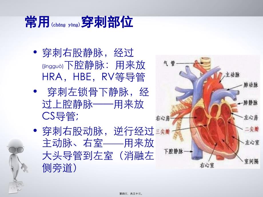 医学专题—心脏射频消融术_第4页