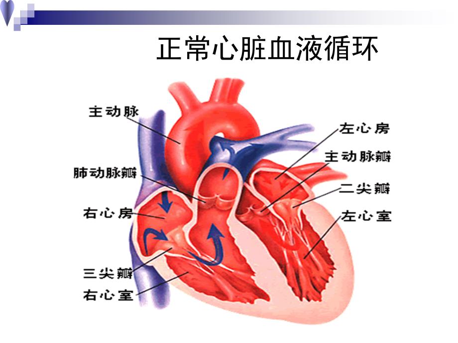 心脏瓣膜病ppt课件_第3页