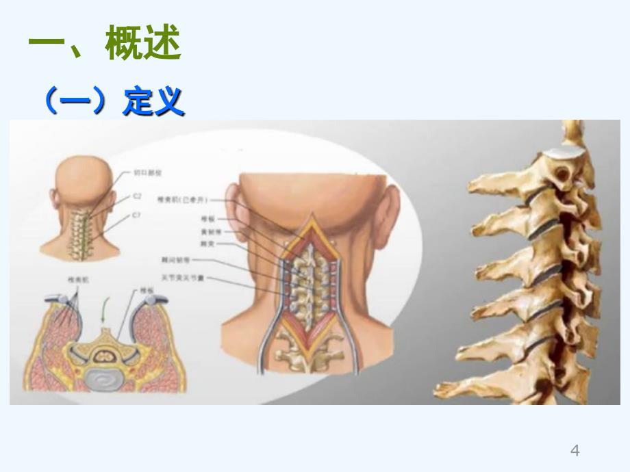 第三章常见肌肉骨骼系统疾病康复47节_第4页