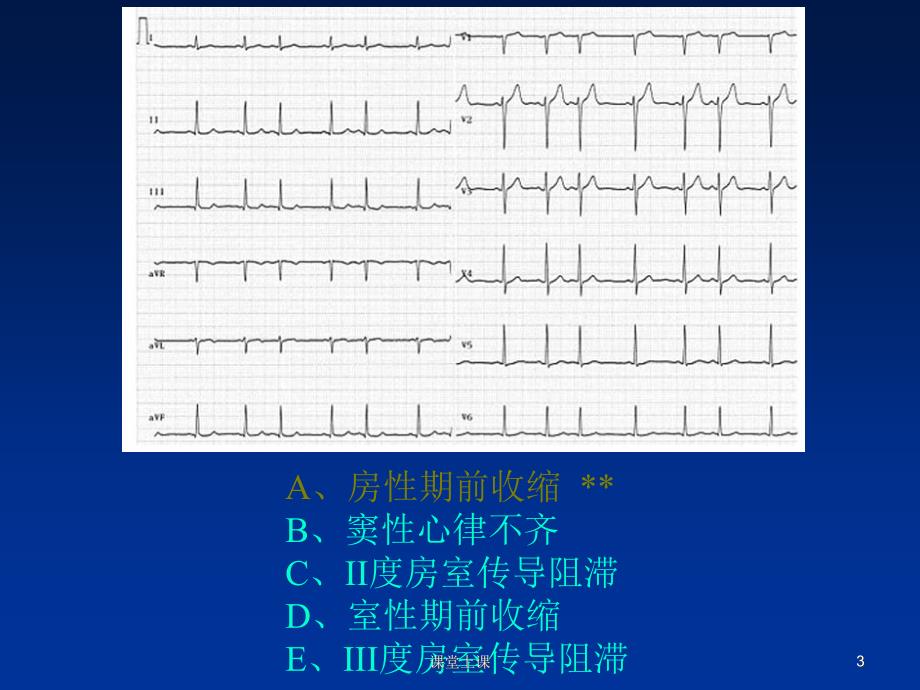 临床技能考试辅助检查结果判读（行业经验）_第3页