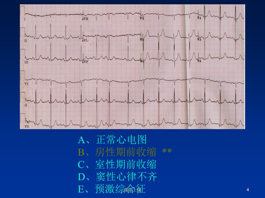 临床技能考试辅助检查结果判读（行业经验）_第4页