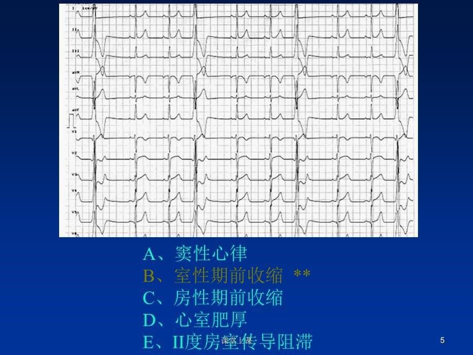 临床技能考试辅助检查结果判读（行业经验）_第5页