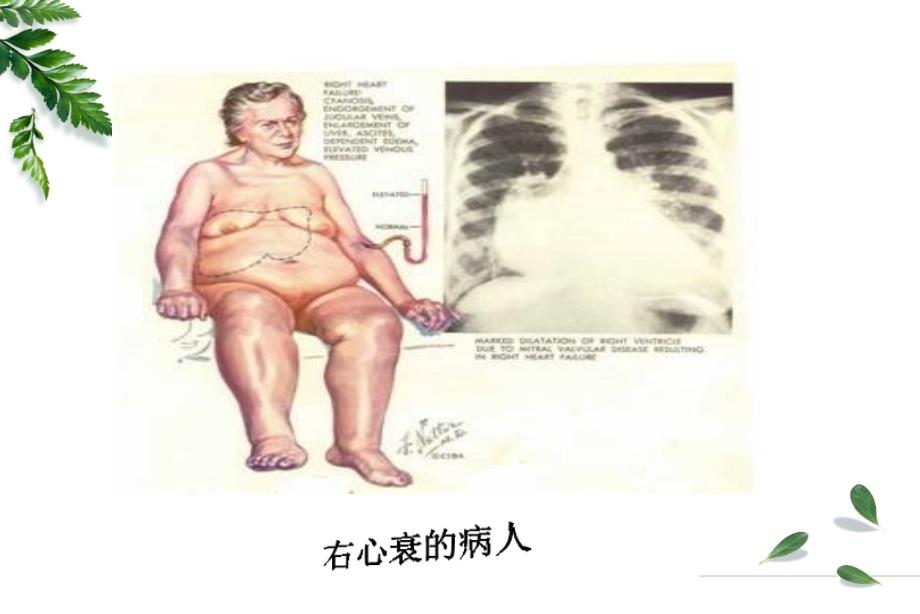 病理生理学pathophysiology病理生理学是一门研究患病机体的生命_第4页