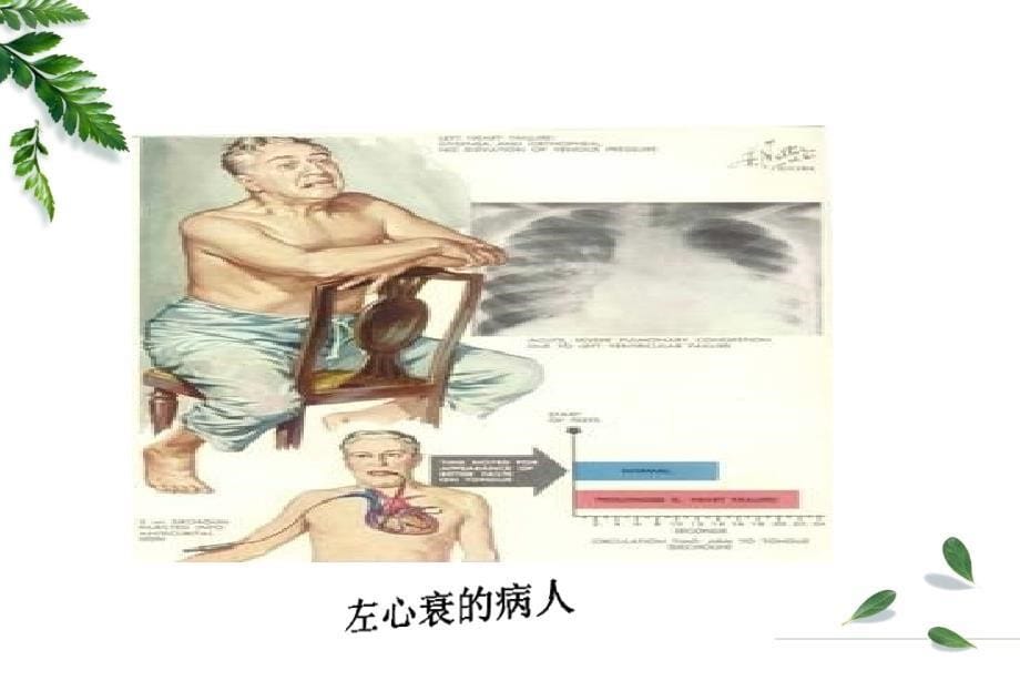 病理生理学pathophysiology病理生理学是一门研究患病机体的生命_第5页