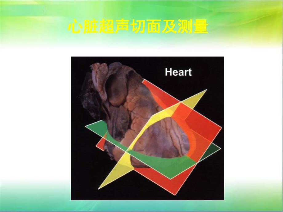 心脏超声标准切面及测量_第1页