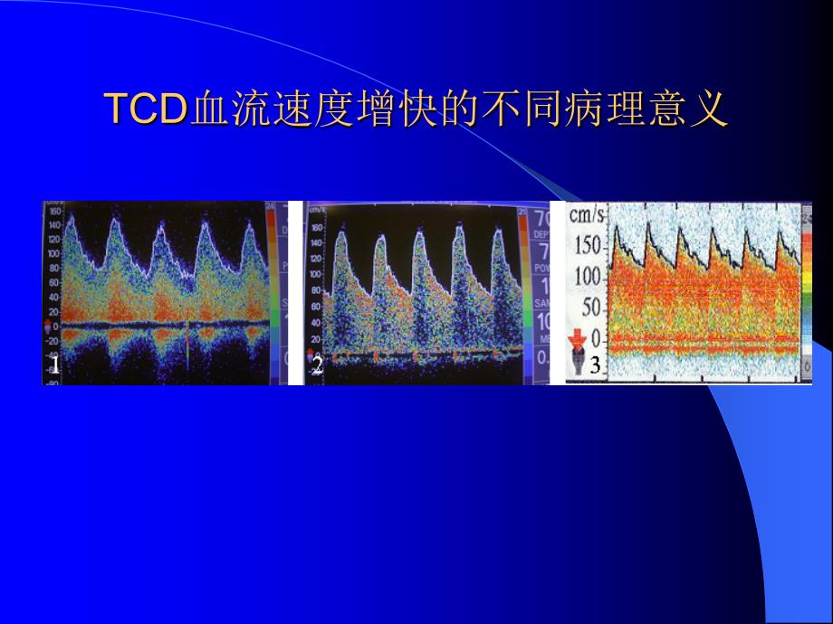 脑血流速度增快或减慢的病理意义_第3页