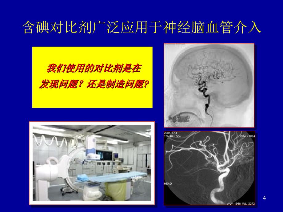 马根山预防对比剂急性肾损害CIAKI的策略_第4页