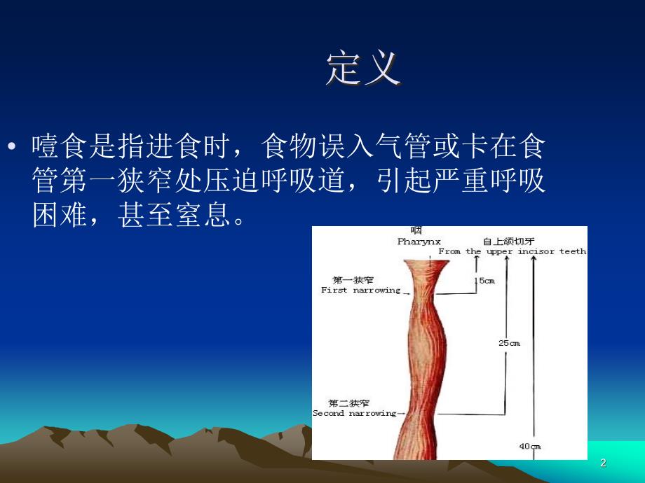 （优质课件）精神病人噎食护理_第2页