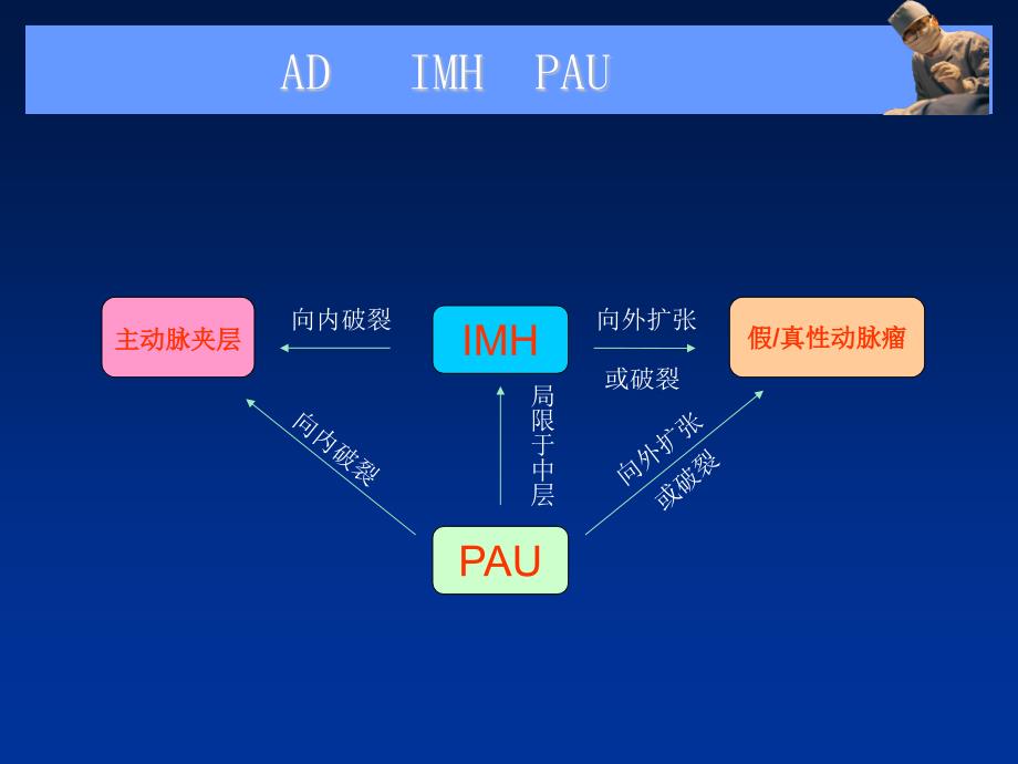 主动脉夹层、壁间血肿及穿通性溃疡的影像诊断与鉴别诊断_第3页