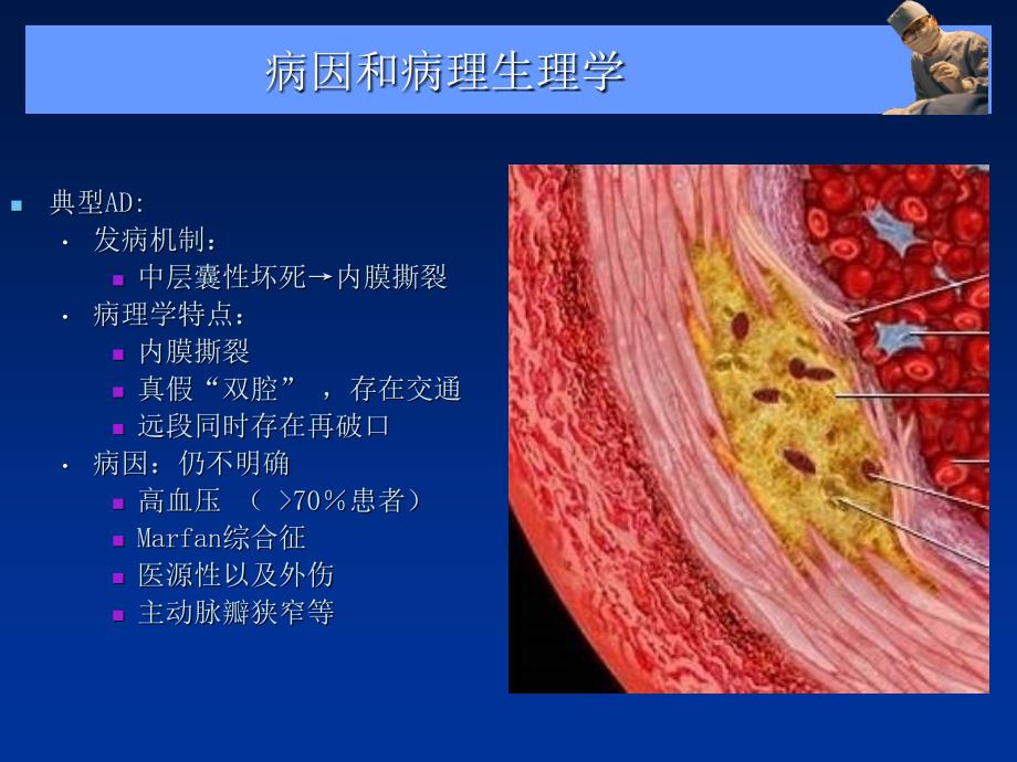 主动脉夹层、壁间血肿及穿通性溃疡的影像诊断与鉴别诊断_第4页