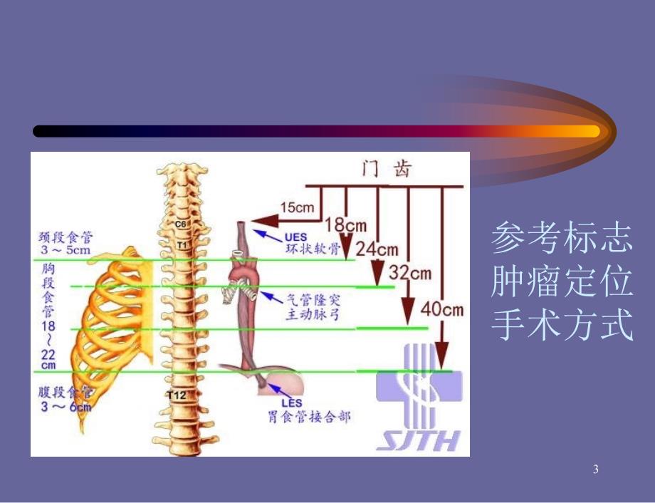 食管解剖ppt课件_第3页