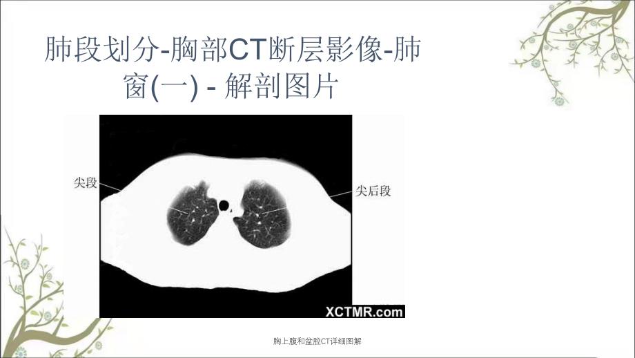 胸上腹和盆腔CT详细图解_第2页