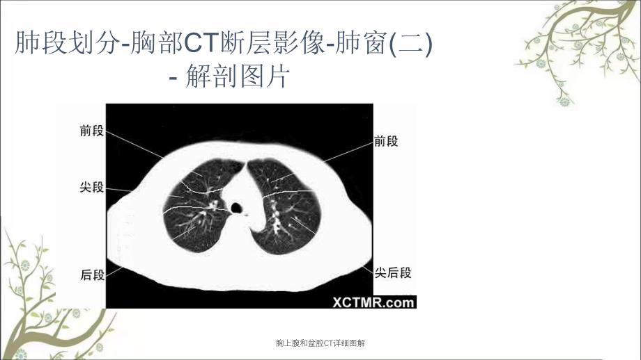 胸上腹和盆腔CT详细图解_第3页