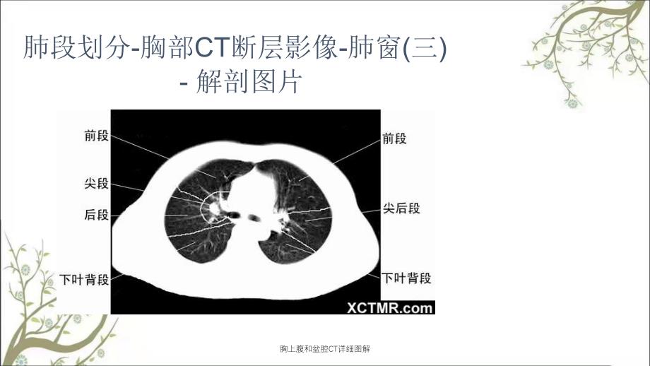 胸上腹和盆腔CT详细图解_第4页