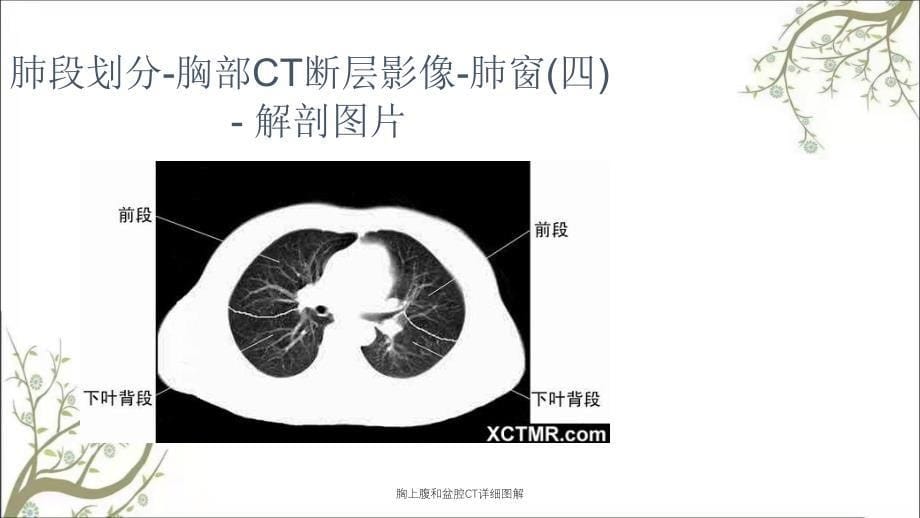 胸上腹和盆腔CT详细图解_第5页