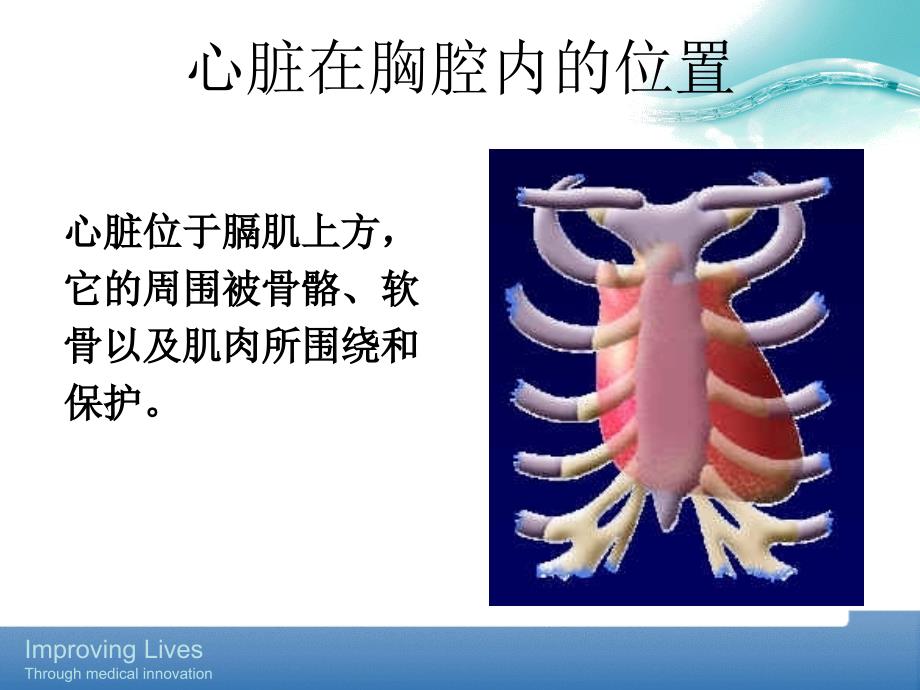 PTCA基础知识_第3页