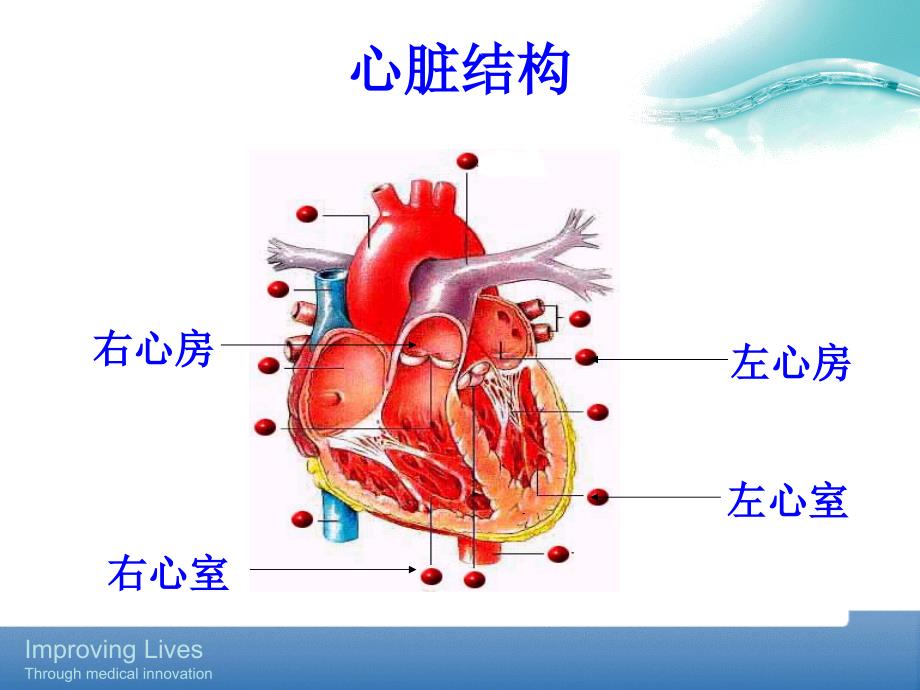 PTCA基础知识_第4页