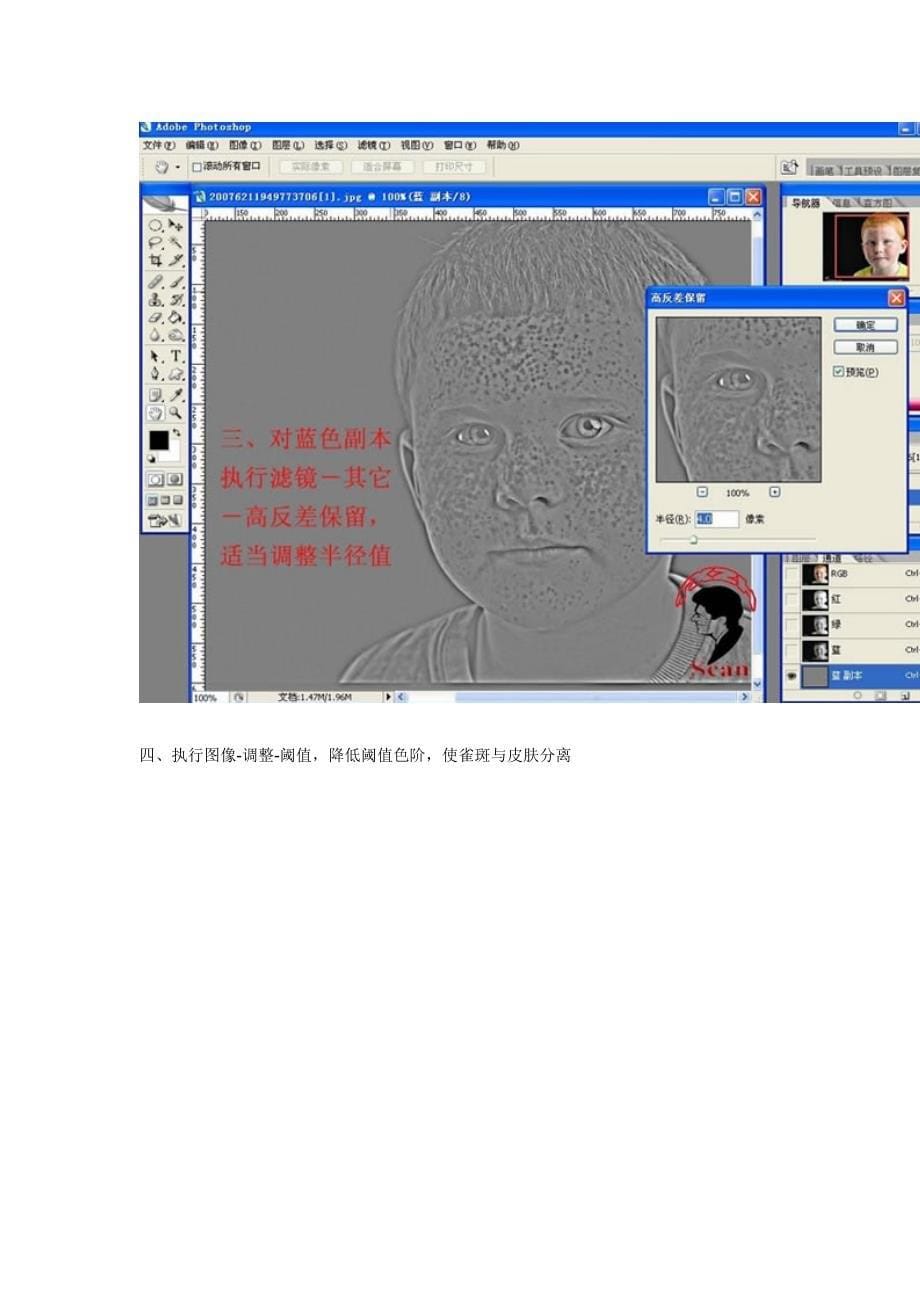 通道和高反差保留PS磨皮方法给满脸雀斑的小男孩祛斑_第5页