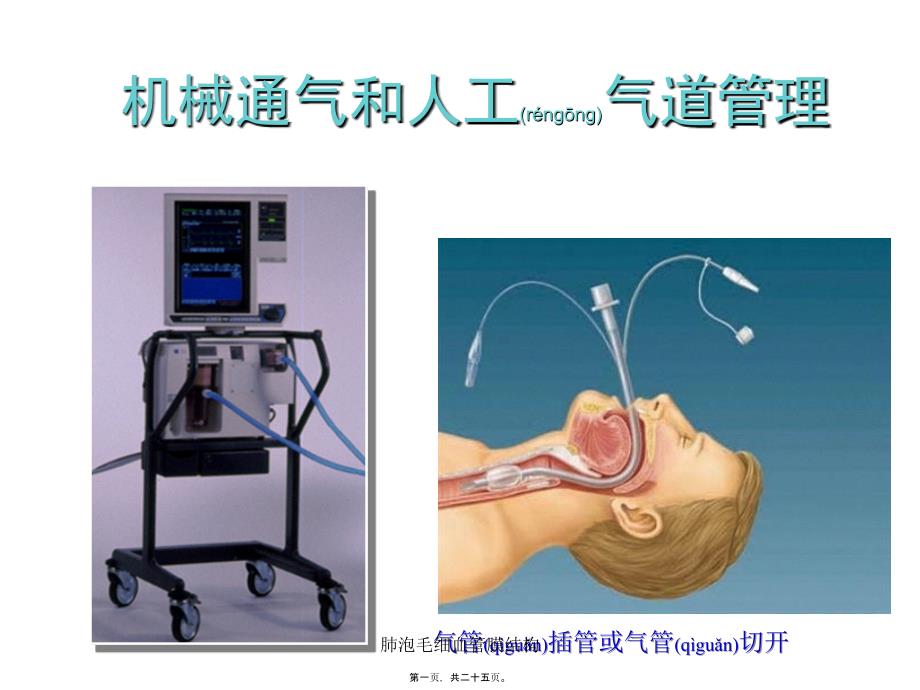 肺泡毛细血管膜结构课件_第1页